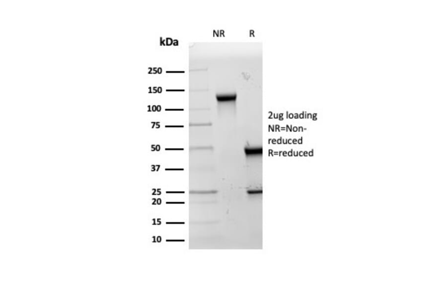 SDS-PAGE - Anti-HSP60 Antibody [LK2] - BSA and Azide free (A252065) - Antibodies.com
