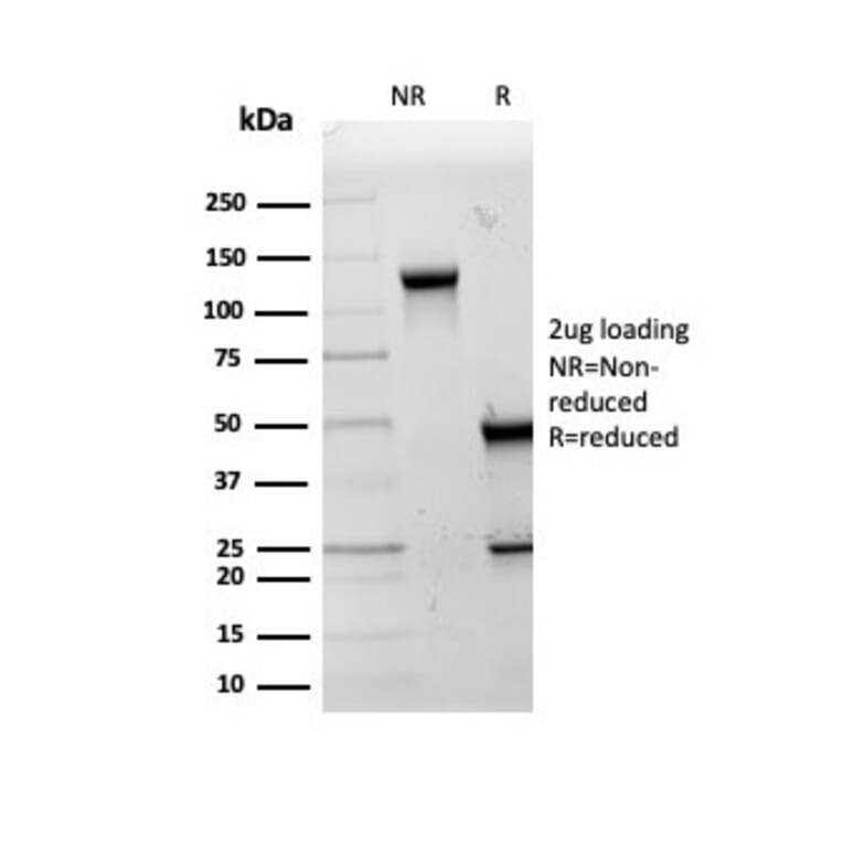 SDS-PAGE - Anti-HSP60 Antibody [LK2] - BSA and Azide free (A252065) - Antibodies.com