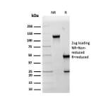 SDS-PAGE - Anti-HSP60 Antibody [LK2] - BSA and Azide free (A252065) - Antibodies.com