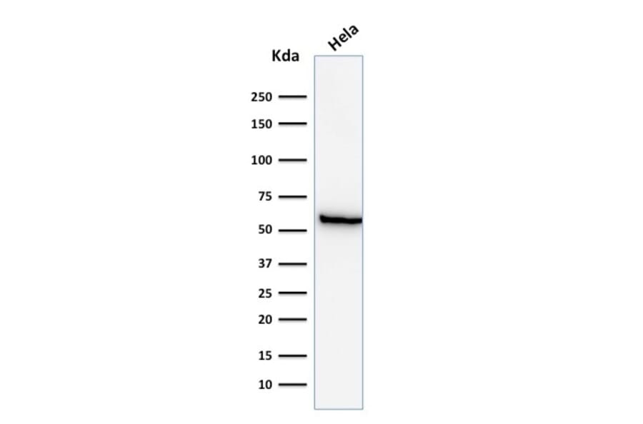 Western Blot - Anti-HSP60 Antibody [GROEL/730] - BSA and Azide free (A252066) - Antibodies.com