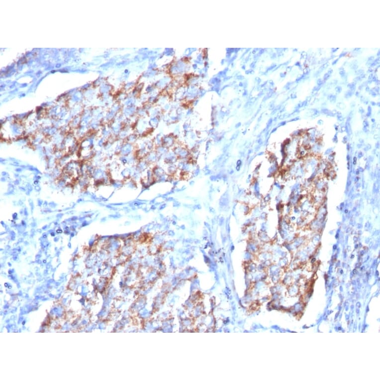 Immunohistochemistry - Anti-HSP60 Antibody [HSPD1/780] - BSA and Azide free (A252067) - Antibodies.com