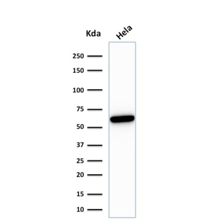Western Blot - Anti-HSP60 Antibody [HSPD1/780] - BSA and Azide free (A252067) - Antibodies.com