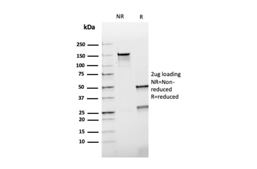 SDS-PAGE - Anti-HSP60 Antibody [rGROEL/780] - BSA and Azide free (A252069) - Antibodies.com