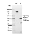 SDS-PAGE - Anti-HSP60 Antibody [rGROEL/780] - BSA and Azide free (A252069) - Antibodies.com