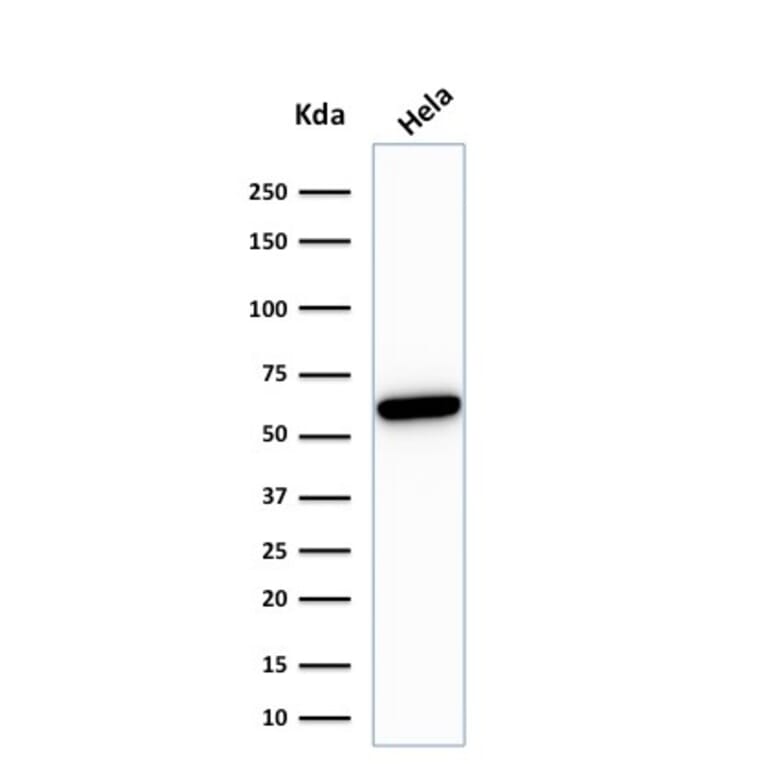 Western Blot - Anti-HSP60 Antibody [rGROEL/780] - BSA and Azide free (A252069) - Antibodies.com