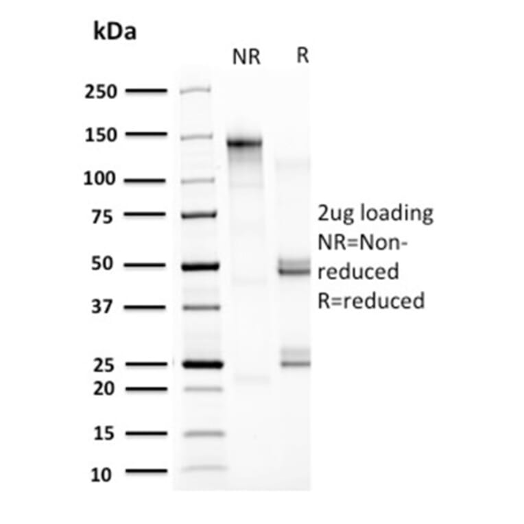 SDS-PAGE - Anti-HSP60 Antibody [CPTC-HSPD1-1] - BSA and Azide free (A252070) - Antibodies.com