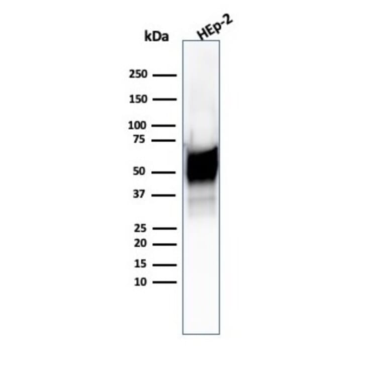 Western Blot - Anti-HSP60 Antibody [HSPD1/6496R] - BSA and Azide free (A252072) - Antibodies.com