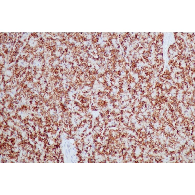 Immunohistochemistry - Anti-HSP60 Antibody [HSPD1/2206R] - BSA and Azide free (A252072) - Antibodies.com