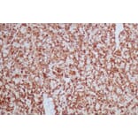 Immunohistochemistry - Anti-HSP60 Antibody [HSPD1/2206R] - BSA and Azide free (A252072) - Antibodies.com