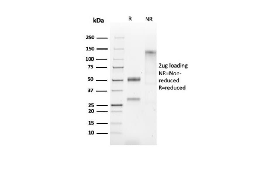 SDS-PAGE - Anti-HSP60 Antibody [HSPD1/2206R] - BSA and Azide free (A252073) - Antibodies.com