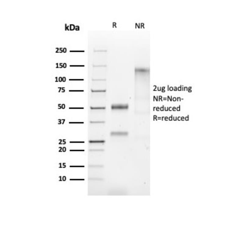 SDS-PAGE - Anti-HSP60 Antibody [HSPD1/2206R] - BSA and Azide free (A252073) - Antibodies.com