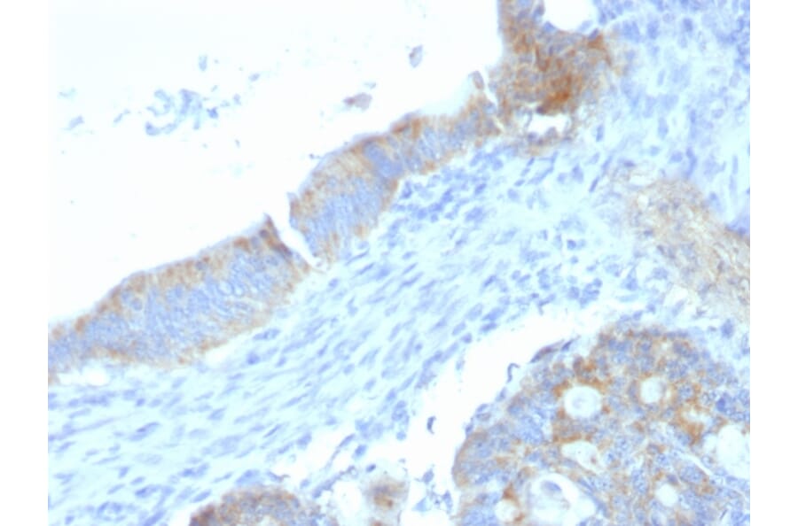 Immunohistochemistry - Anti-Heparan Sulfate Proteoglycan Antibody [SPM255] - BSA and Azide free (A252074) - Antibodies.com