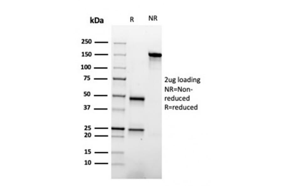 SDS-PAGE - Anti-Apolipoprotein A1 Antibody [APOA1/3661] - BSA and Azide free (A252076) - Antibodies.com