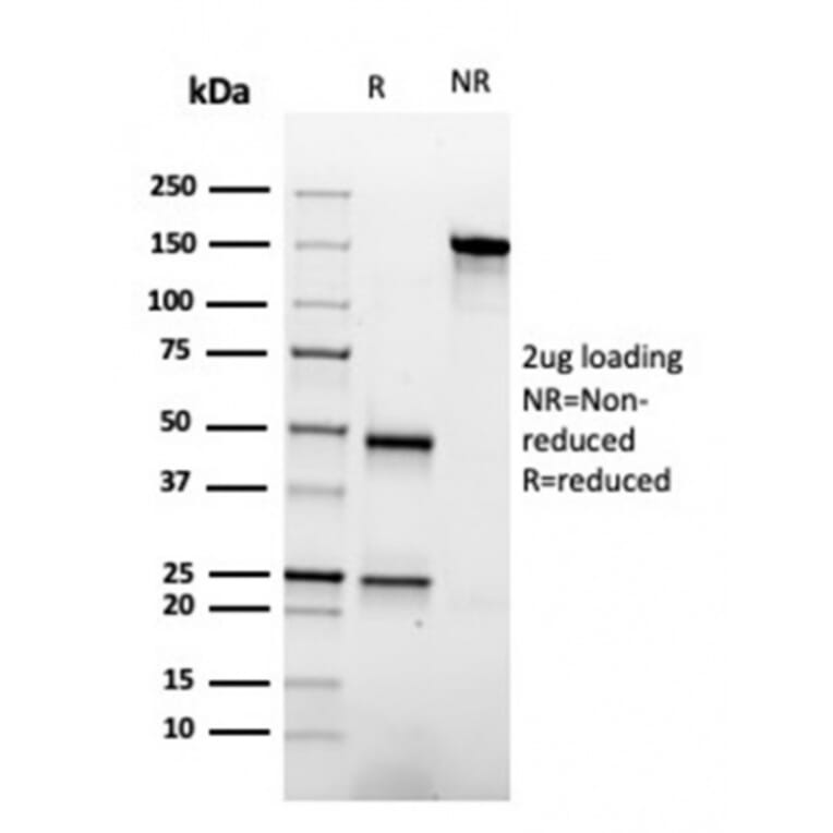 SDS-PAGE - Anti-Apolipoprotein A1 Antibody [APOA1/3661] - BSA and Azide free (A252076) - Antibodies.com