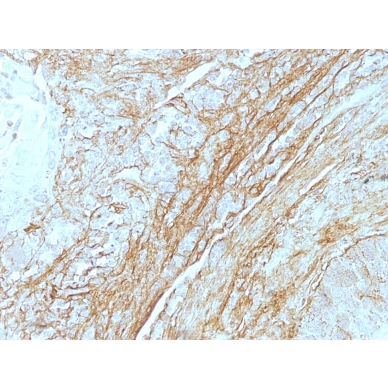 Immunohistochemistry - Anti-Tenascin C Antibody [T2H5] - BSA and Azide free (A252076) - Antibodies.com