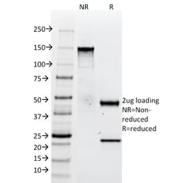 SDS-PAGE - Anti-Tenascin C Antibody [SPM319] - BSA and Azide free (A252078) - Antibodies.com