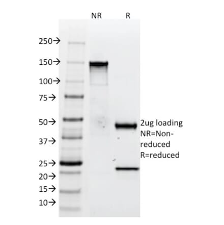 SDS-PAGE - Anti-Tenascin C Antibody [SPM319] - BSA and Azide free (A252078) - Antibodies.com
