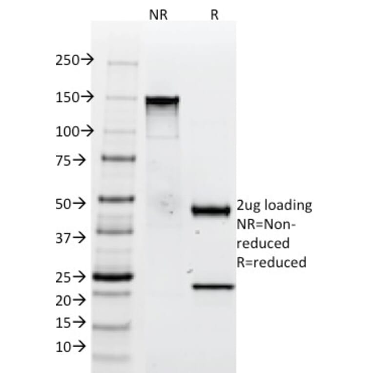 SDS-PAGE - Anti-Tenascin C Antibody [SPM319] - BSA and Azide free (A252078) - Antibodies.com