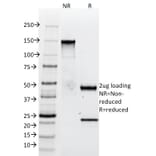 SDS-PAGE - Anti-Tenascin C Antibody [SPM319] - BSA and Azide free (A252078) - Antibodies.com