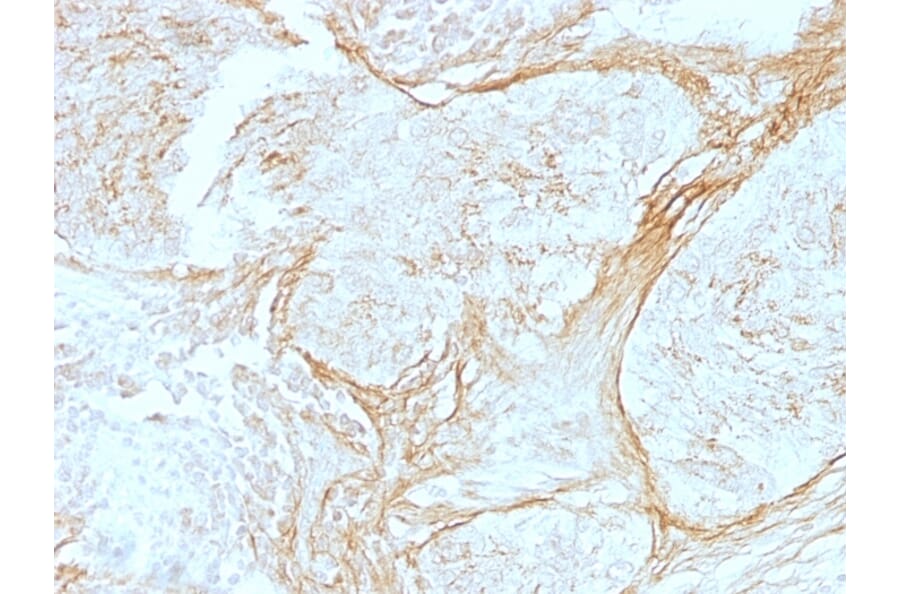 Immunohistochemistry - Anti-Tenascin C Antibody [SPM319] - BSA and Azide free (A252077) - Antibodies.com
