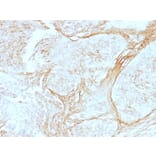 Immunohistochemistry - Anti-Tenascin C Antibody [SPM319] - BSA and Azide free (A252077) - Antibodies.com
