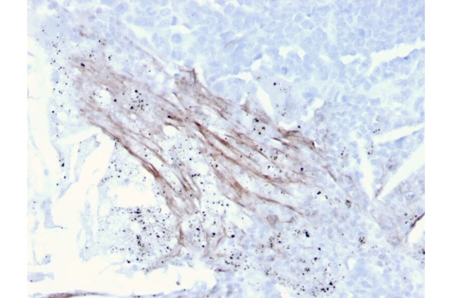 Immunohistochemistry - Anti-Tenascin C Antibody [rTNC/3635] - BSA and Azide free (A252078) - Antibodies.com