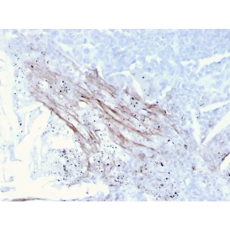 Immunohistochemistry - Anti-Tenascin C Antibody [rTNC/3635] - BSA and Azide free (A252078) - Antibodies.com