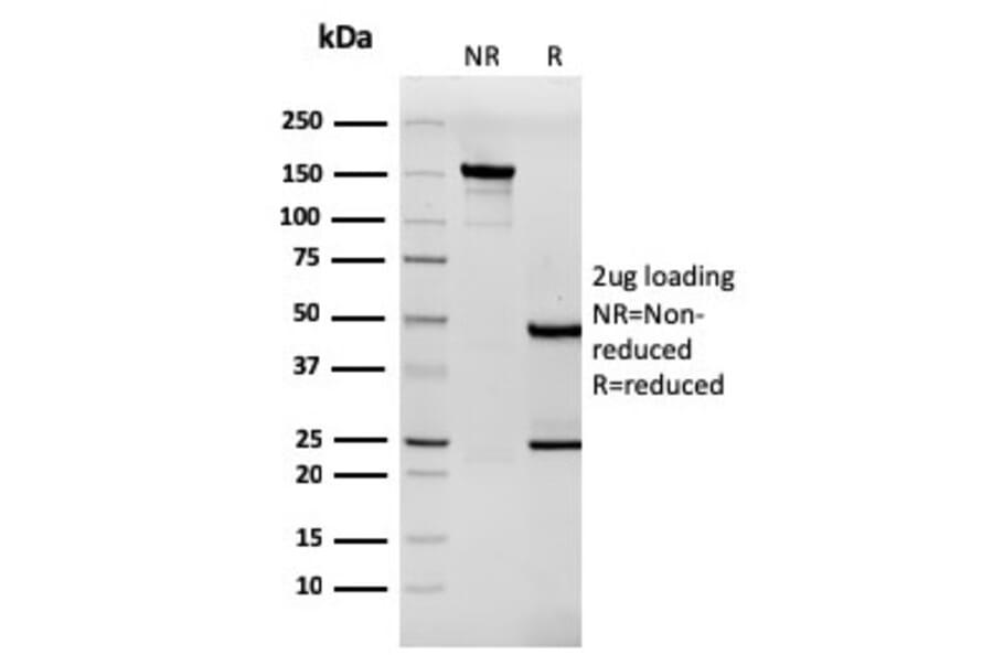 SDS-PAGE - Anti-Tenascin C Antibody [rTNC/3635] - BSA and Azide free (A252079) - Antibodies.com