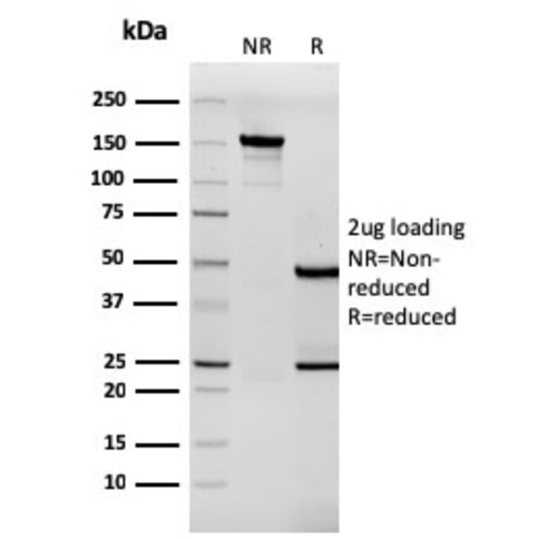 SDS-PAGE - Anti-Tenascin C Antibody [rTNC/3635] - BSA and Azide free (A252079) - Antibodies.com