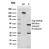 SDS-PAGE - Anti-Tenascin C Antibody [rTNC/3635] - BSA and Azide free (A252079) - Antibodies.com