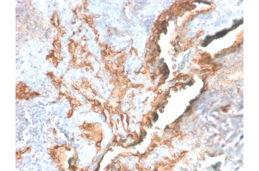 Immunohistochemistry - Anti-Tenascin C Antibody [TNC/2981R] - BSA and Azide free (A252079) - Antibodies.com