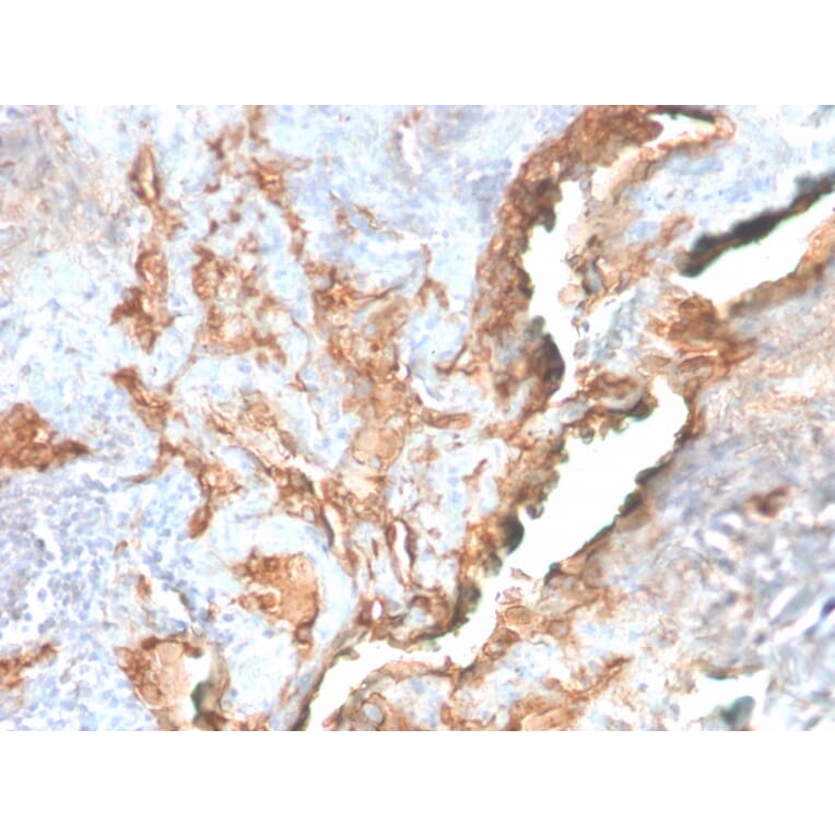 Immunohistochemistry - Anti-Tenascin C Antibody [TNC/2981R] - BSA and Azide free (A252079) - Antibodies.com