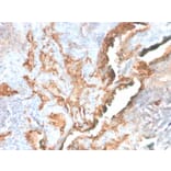 Immunohistochemistry - Anti-Tenascin C Antibody [TNC/2981R] - BSA and Azide free (A252079) - Antibodies.com