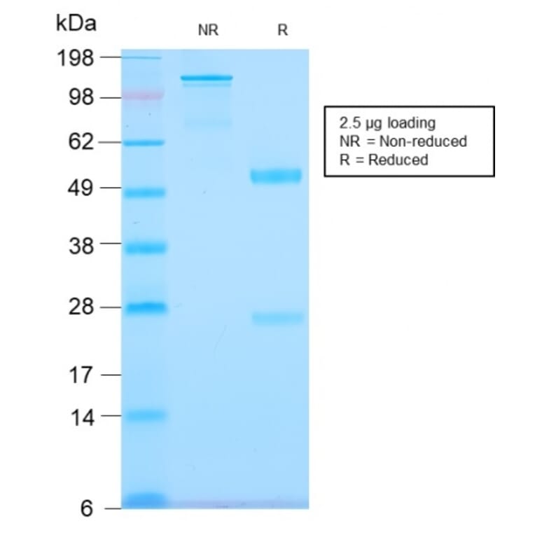 SDS-PAGE - Anti-Tenascin C Antibody [TNC/2981R] - BSA and Azide free (A252080) - Antibodies.com