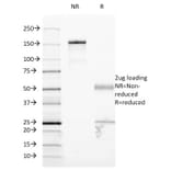 SDS-PAGE - Anti-ICAM1 Antibody [W-CAM-1] - BSA and Azide free (A252082) - Antibodies.com