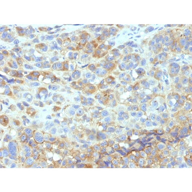 Immunohistochemistry - Anti-ICAM1 Antibody [W-CAM-1] - BSA and Azide free (A252081) - Antibodies.com