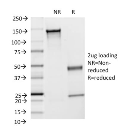 SDS-PAGE - Anti-ICAM1 Antibody [F4-31C2] - BSA and Azide free (A252082) - Antibodies.com