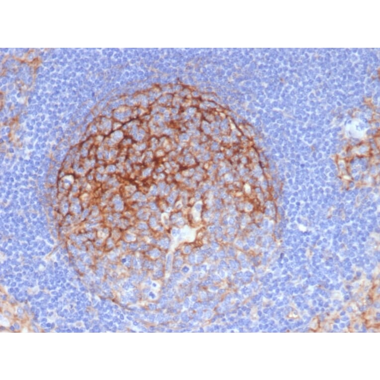 Immunohistochemistry - Anti-ICAM1 Antibody [P2A4] - BSA and Azide free (A252085) - Antibodies.com