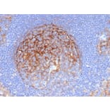 Immunohistochemistry - Anti-ICAM1 Antibody [P2A4] - BSA and Azide free (A252085) - Antibodies.com