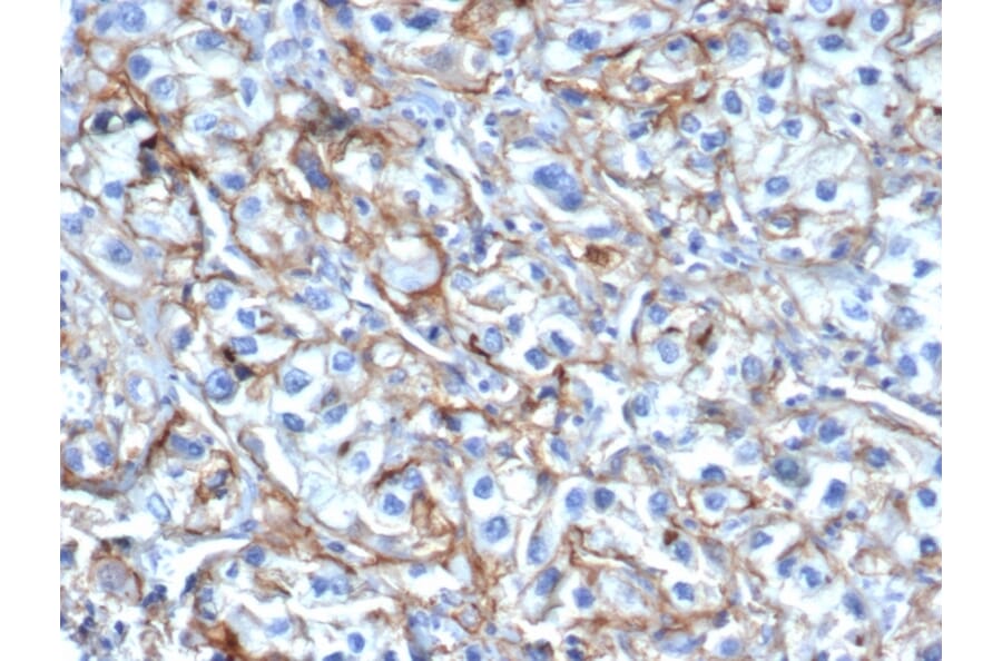 Immunohistochemistry - Anti-ICAM1 Antibody [P2A4] - BSA and Azide free (A252085) - Antibodies.com