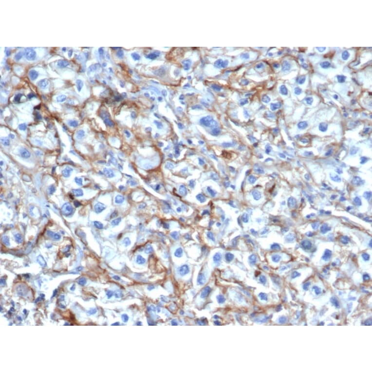 Immunohistochemistry - Anti-ICAM1 Antibody [P2A4] - BSA and Azide free (A252085) - Antibodies.com