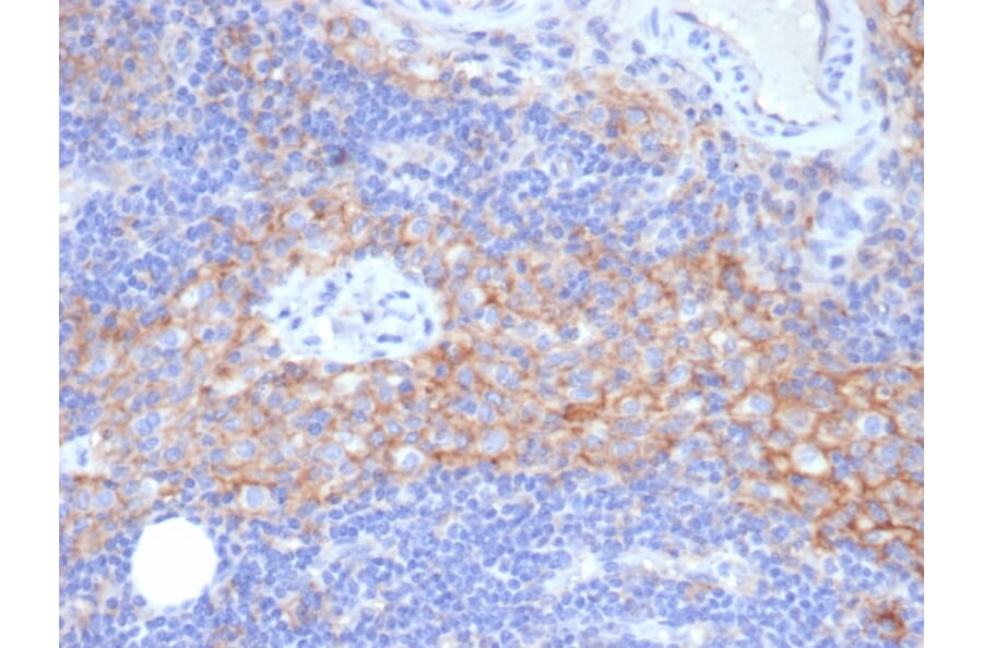 Immunohistochemistry - Anti-ICAM1 Antibody [P2A4] - BSA and Azide free (A252084) - Antibodies.com