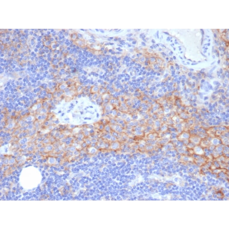 Immunohistochemistry - Anti-ICAM1 Antibody [P2A4] - BSA and Azide free (A252084) - Antibodies.com