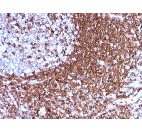 Immunohistochemistry - Anti-ICAM3 Antibody [186-2G9] - BSA and Azide free (A252085) - Antibodies.com