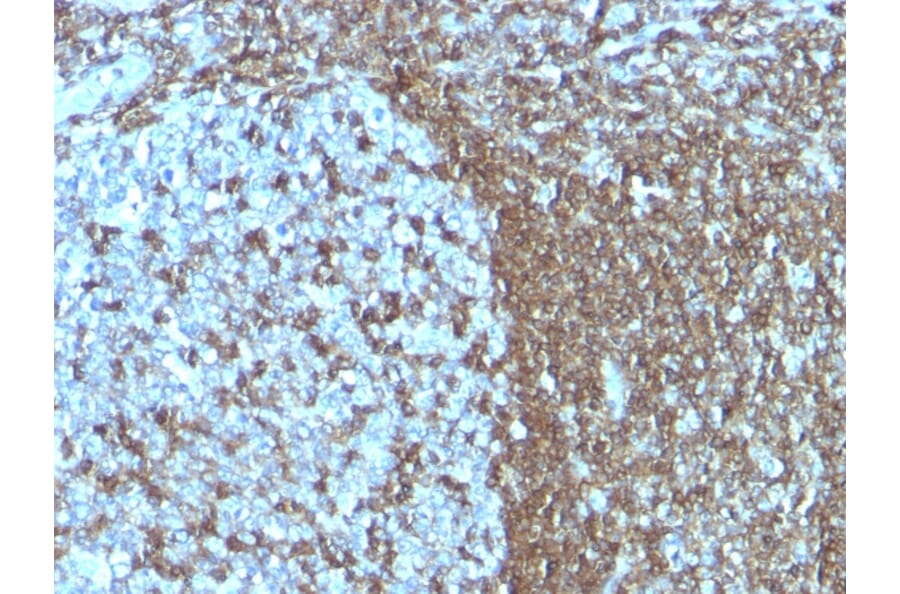 Immunohistochemistry - Anti-ICAM3 Antibody [SPM505] - BSA and Azide free (A252086) - Antibodies.com