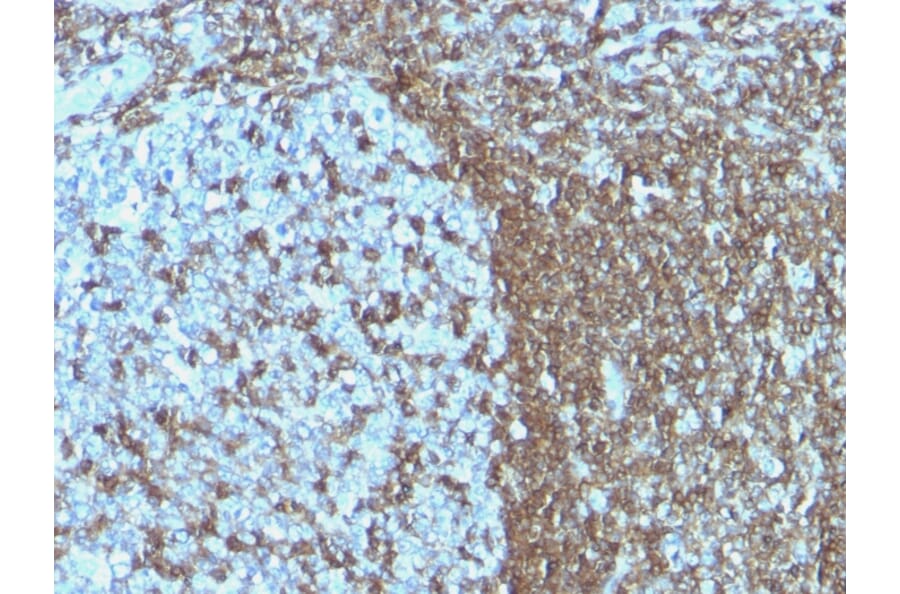 Immunohistochemistry - Anti-ICAM3 Antibody [ICAM3/1019] - BSA and Azide free (A252089) - Antibodies.com