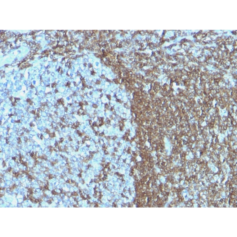 Immunohistochemistry - Anti-ICAM3 Antibody [ICAM3/1019] - BSA and Azide free (A252089) - Antibodies.com