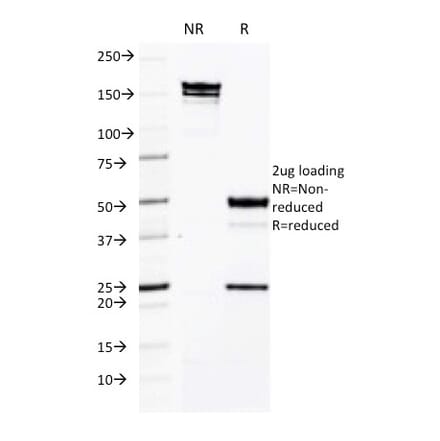 SDS-PAGE - Anti-ICAM3 Antibody [CG106] - BSA and Azide free (A252090) - Antibodies.com