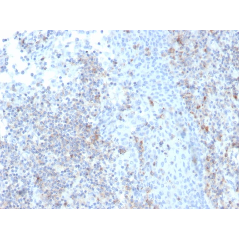 Immunohistochemistry - Anti-ICAM3 Antibody [rICAM3/1019] - BSA and Azide free (A252091) - Antibodies.com