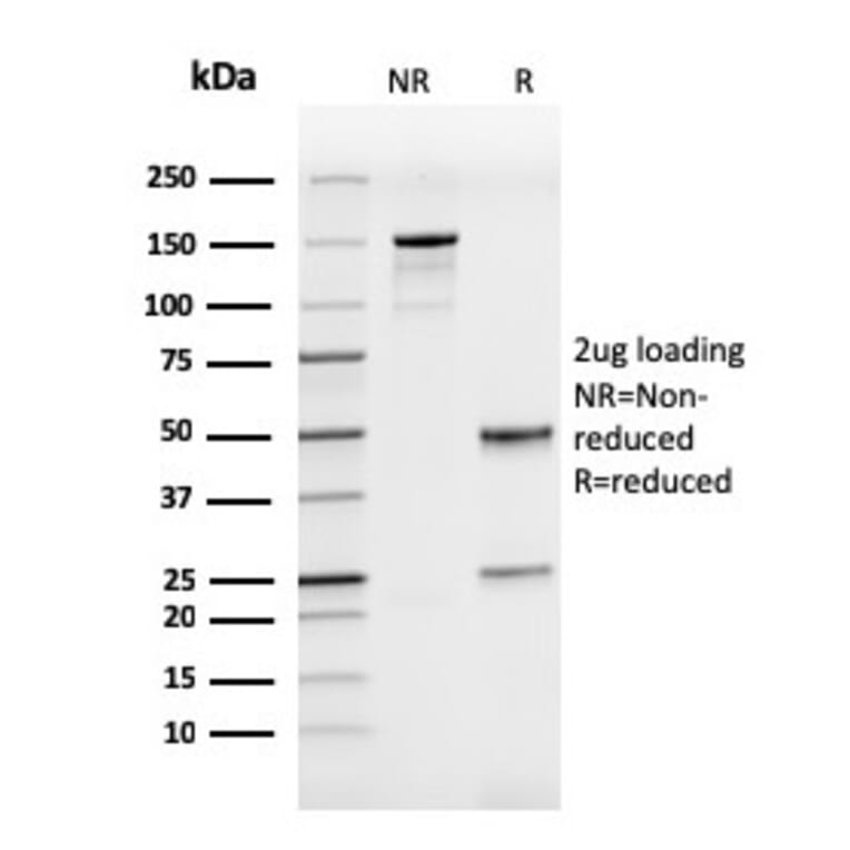 SDS-PAGE - Anti-ICAM3 Antibody [rICAM3/1019] - BSA and Azide free (A252092) - Antibodies.com